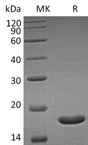 Recombinant Human UBE2B (C-6His)