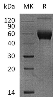 Recombinant Human IL-1RAPL1 (C-6His)