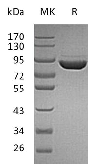Recombinant Human F13A (C-6His)