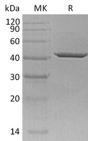Recombinant Human SORD (C-6His)