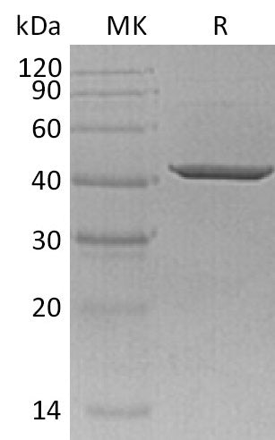 Recombinant Human SORD (C-6His)