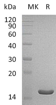 Recombinant Human ACOT13 (C-6His)