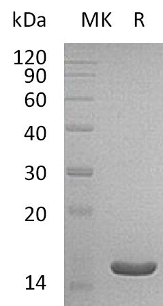 Recombinant Human ACOT13 (C-6His)