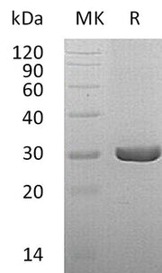 Recombinant Human QDPR (C-6His)