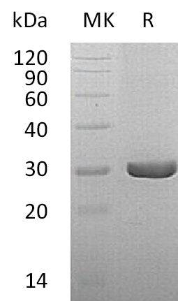 Recombinant Human QDPR (C-6His)