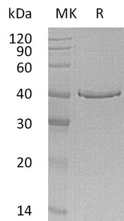 Recombinant Human GMPR (C-6His)
