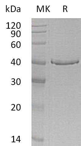 Recombinant Human GMPR (C-6His)