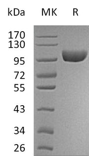 Recombinant Human AOC3 (C-6His)