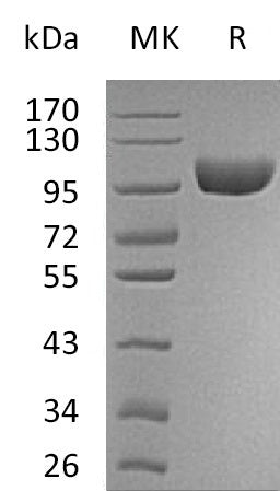 Recombinant Human AOC3 (C-6His)