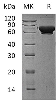 Recombinant Human MAN1B1 (C-6His)