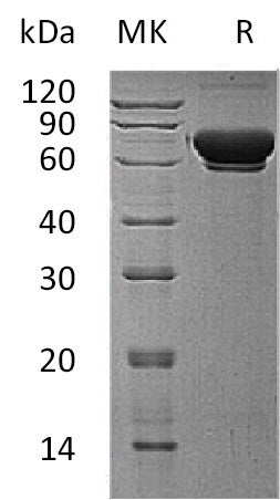 Recombinant Human MAN1B1 (C-6His)