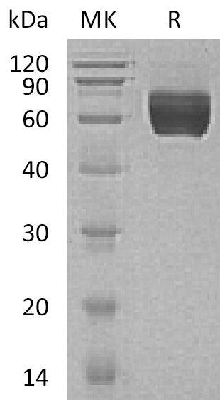 Recombinant Human GALNTL1 (C-6His)