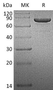 Recombinant Human PRKG1 (C-6His)