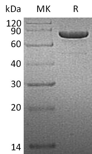 Recombinant Human PRKG1 (C-6His)