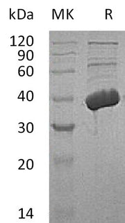 Recombinant Human MECR (C-6His)