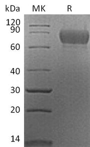 Recombinant Mouse CADM1 (C-6His)