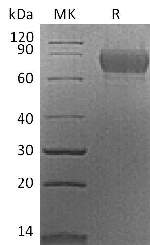 Recombinant Mouse CADM1 (C-6His)