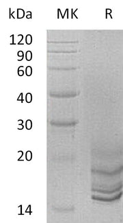 Recombinant Human GNRH2 (C-6His)