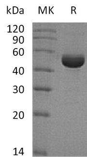 Recombinant Human SHMT1 (C-6His)