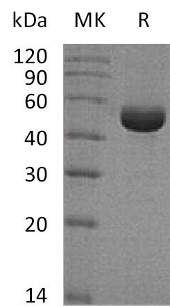 Recombinant Human SHMT1 (C-6His)