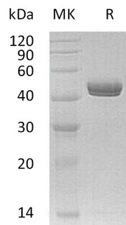 Recombinant Human NTNG1 (C-6His)