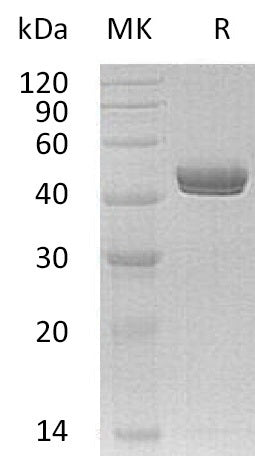 Recombinant Human NTNG1 (C-6His)