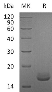 Recombinant Human CALM1