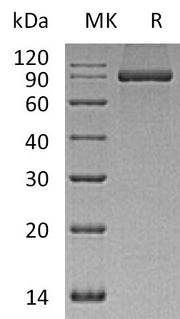 Recombinant Human PACSIN2 (C-6His)