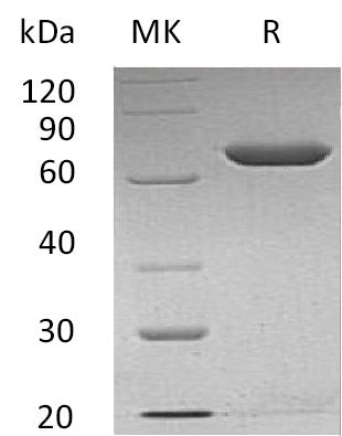 Recombinant Human Calnexin (C-6His)