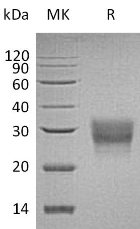 Recombinant Human CD8B (C-6His)