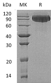 Recombinant Human BCHE (C-6His)