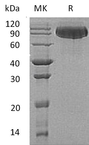 Recombinant Human BCHE (C-6His)