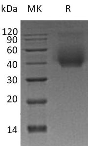 Recombinant Human CD44 (C-6His)