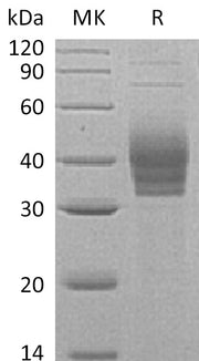 Recombinant Human Cerberus1 (C-6His)