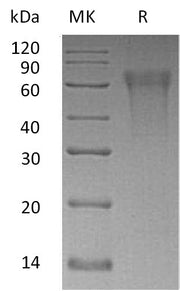 Recombinant Human CLM9 (C-6His)