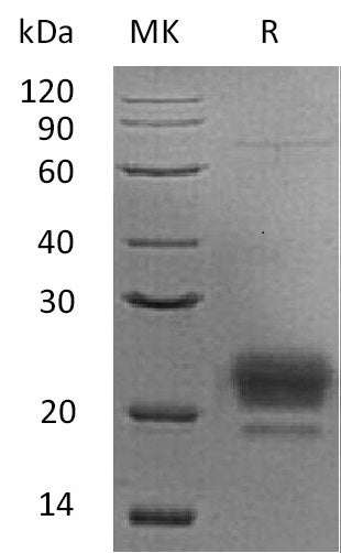 Recombinant Human ApoM (C-6His)