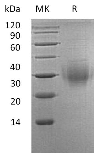 Recombinant Human BTLA (C-6His)