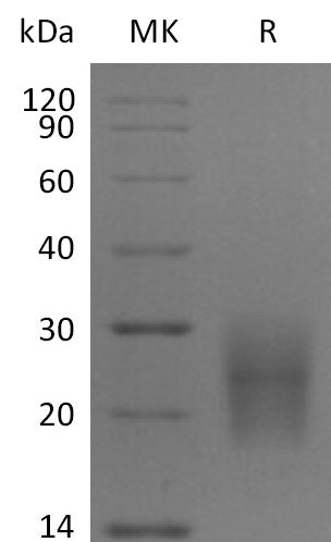 Recombinant Human CD3D (C-6His)