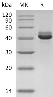 Recombinant Human CD5L (C-6His)