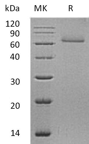 Recombinant Human CDSN (C-6His)