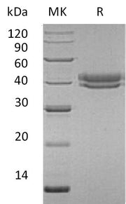 Recombinant Human CFHR1 (C-6His)