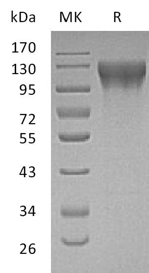 Recombinant Human ECE-1 (N-8His)