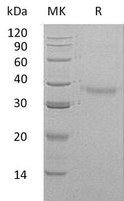 Recombinant Human CRHBP (C-6His)