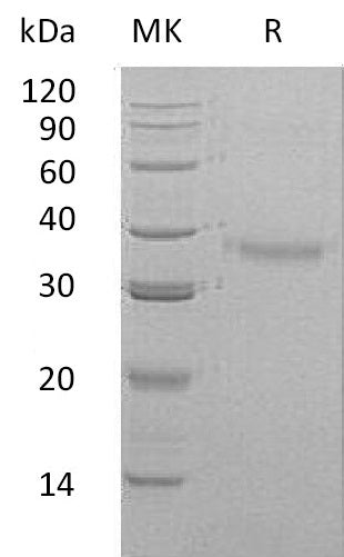 Recombinant Human CRHBP (C-6His)