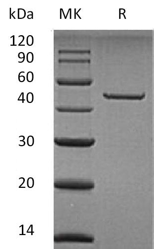 Recombinant Human CPA2 (C-6His)