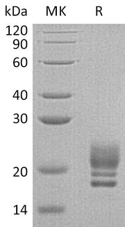 Recombinant Human COQ7 (C-6His)