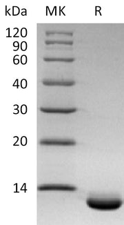 Recombinant Human CXCL6 (C-6His)