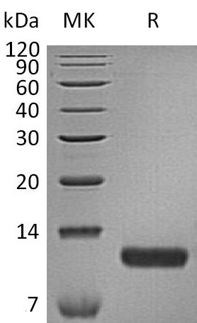 Recombinant Human CCL17 (C-6His)