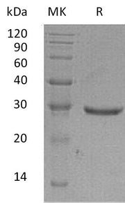 Recombinant Human GLIPR1 (C-6His)