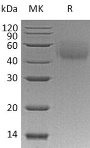 Recombinant Human LYVE-1 (C-6His)